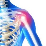 Why do I wake up with sore shoulders? –22/02/2015
